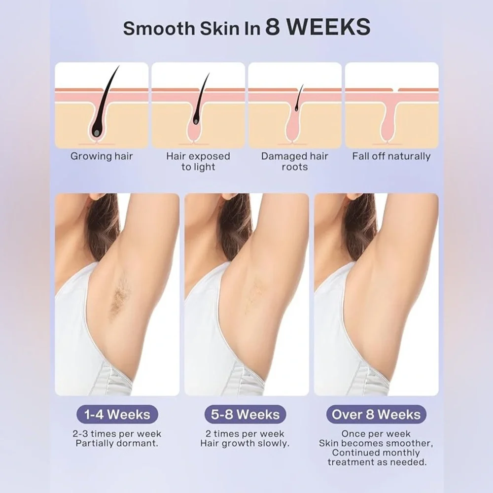 New Permanent Laser Hair Removal Device - Picture 3 of 6